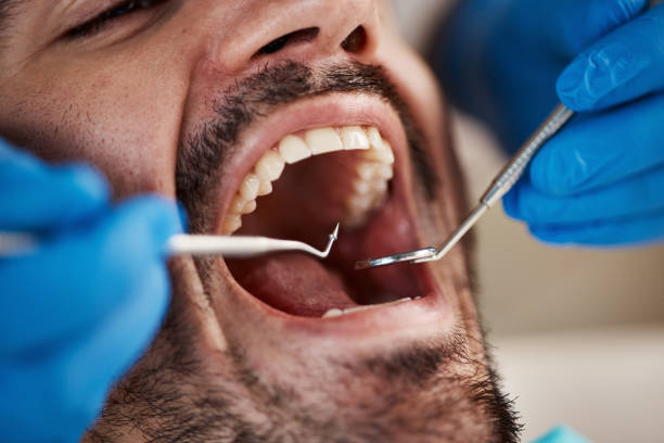 Best Emergency Dental Care for Trauma or Injury in North Bennington, VT