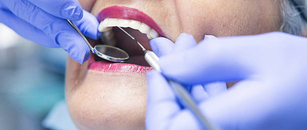 Best Emergency Broken Tooth Repair in North Bennington, VT