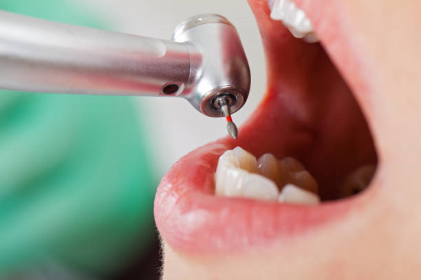 Best Emergency Treatment for Toothache in North Bennington, VT
